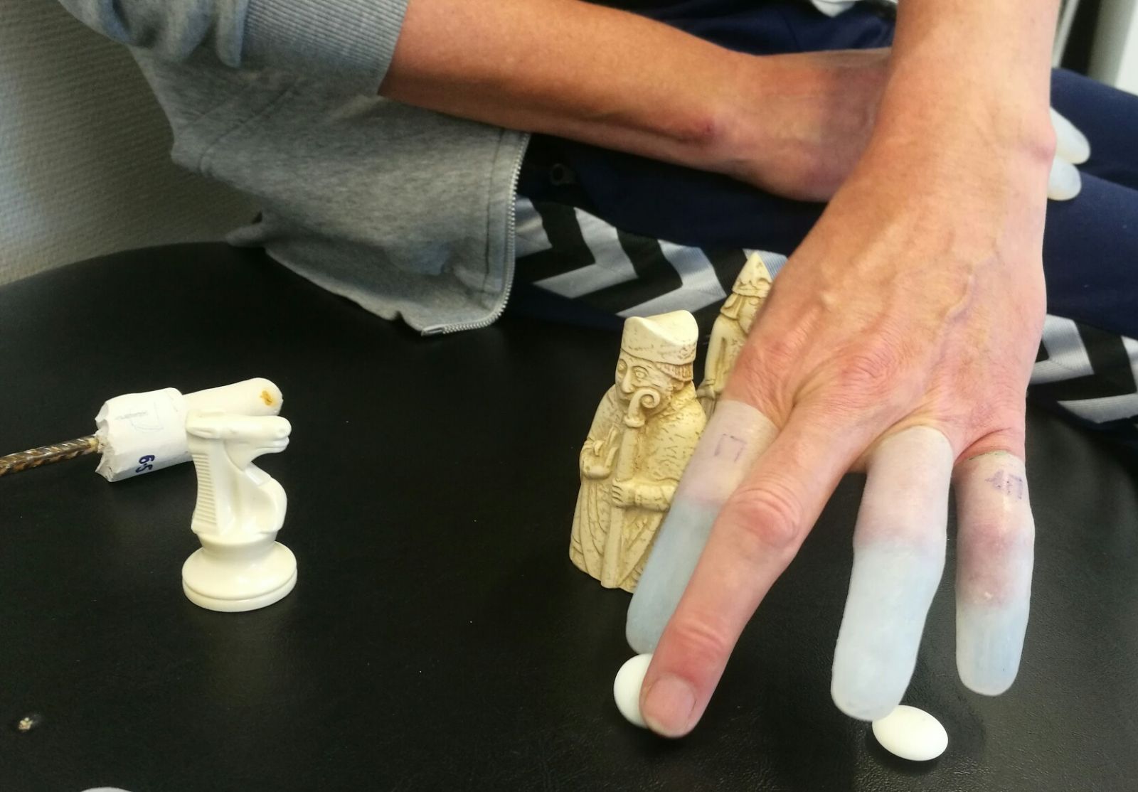 Præcisionsgreb med fingerproteser. Da det stadig er testproteser, er de transparente.